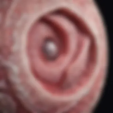 Magnificent An In-Depth Examination of Stage 3 Infiltrating Ductal Carcinoma Magnificent An In-Depth Examination of Stage 3 Infiltrating Ductal Carcinoma