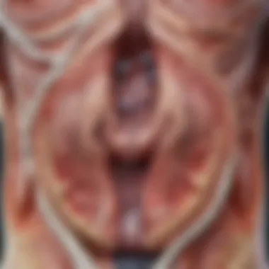 Anatomical Insights into Hiatal Hernia Diagram showcasing anatomy affected by hiatal hernia