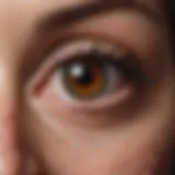 Illustration depicting the various types of benign eye tumors including hemangiomas and lymphangiomas