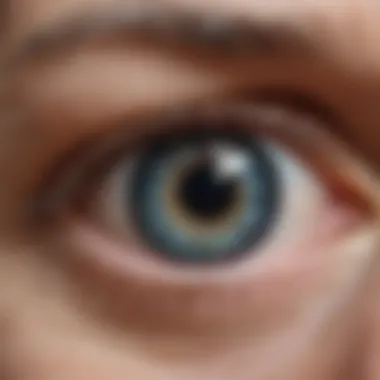 A close-up of an elderly person's eye showing signs of cataract development.