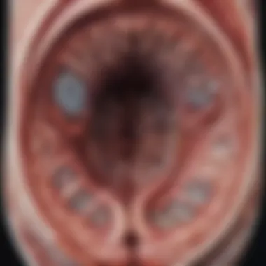 CT Imaging for Assessing NEC Severity Contrast-enhanced CT scan highlighting areas of necrosis in the intestines of neonates.