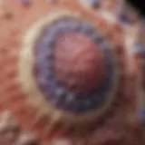Microscopic view of intraepidermal squamous cell carcinoma