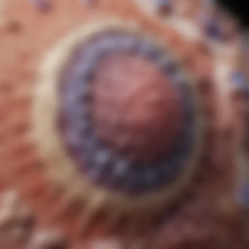 Microscopic view of intraepidermal squamous cell carcinoma