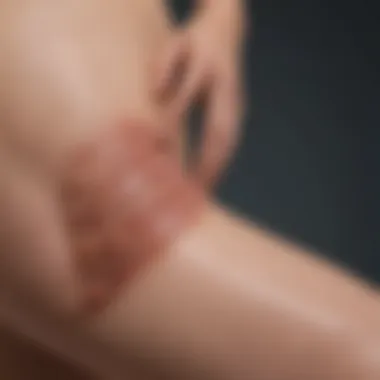 Visual representation of common symptoms associated with lymphedema