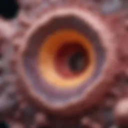 Microscopic view of malignant tenosynovial giant cell tumor pathology