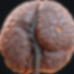 Detailed MRI scan highlighting brain lesions associated with MS