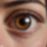 Illustration of intraocular pressure measurement
