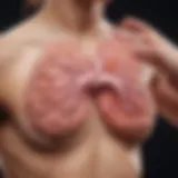 Illustration of lung metastasis in breast cancer