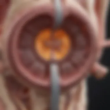 Mechanism of Radiation Therapy in Stomach Cancer A detailed diagram illustrating the mechanism of radiation therapy targeting stomach cancer cells.
