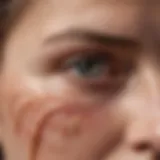 Close-up of skin affected by scleroderma showing fibrosis