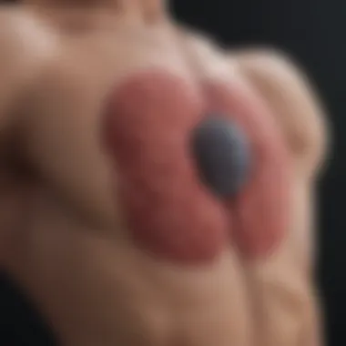 T3a Prostate Cancer Treatment: An In-Depth Exploration Introduction