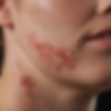 A close-up view of skin lesions typical of psoriasiform dermatitis, showcasing their characteristics.