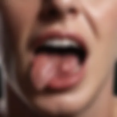 Treatment Options for Tongue Blisters Chart of treatment options for tongue blisters
