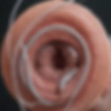 Techniques for Deploying Airway Stents Illustration of airway stent deployment techniques