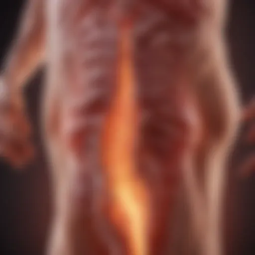Illustration depicting the inflammation of the colon
