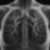 Detailed view of a chest X-ray showing lung structures