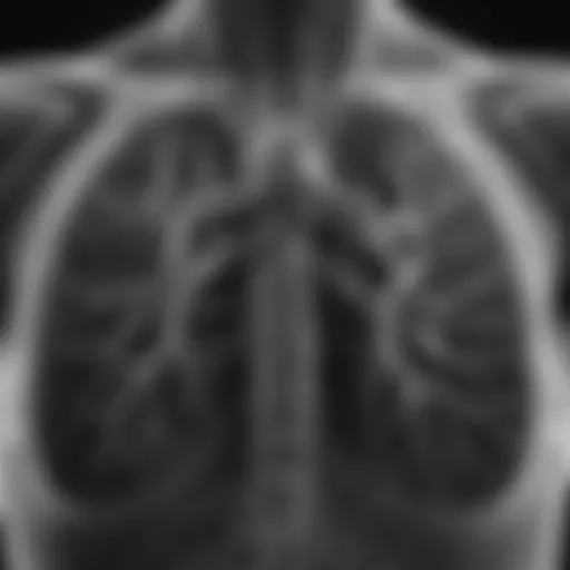 Detailed view of a chest X-ray showing lung structures