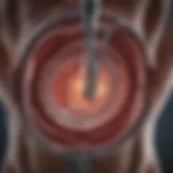 Illustration of the duodenal switch surgical procedure