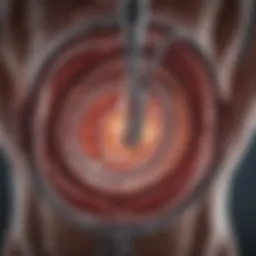 Illustration of the duodenal switch surgical procedure