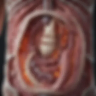 Lower Intestinal Infection Sites Visual representation of the lower intestinal tract highlighting infection sites.
