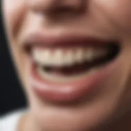 Detailed diagram illustrating the stages of periodontal disease
