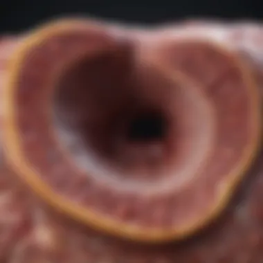 Liver Diagram Illustrating Fatty Deposits Diagram of liver with fatty deposits